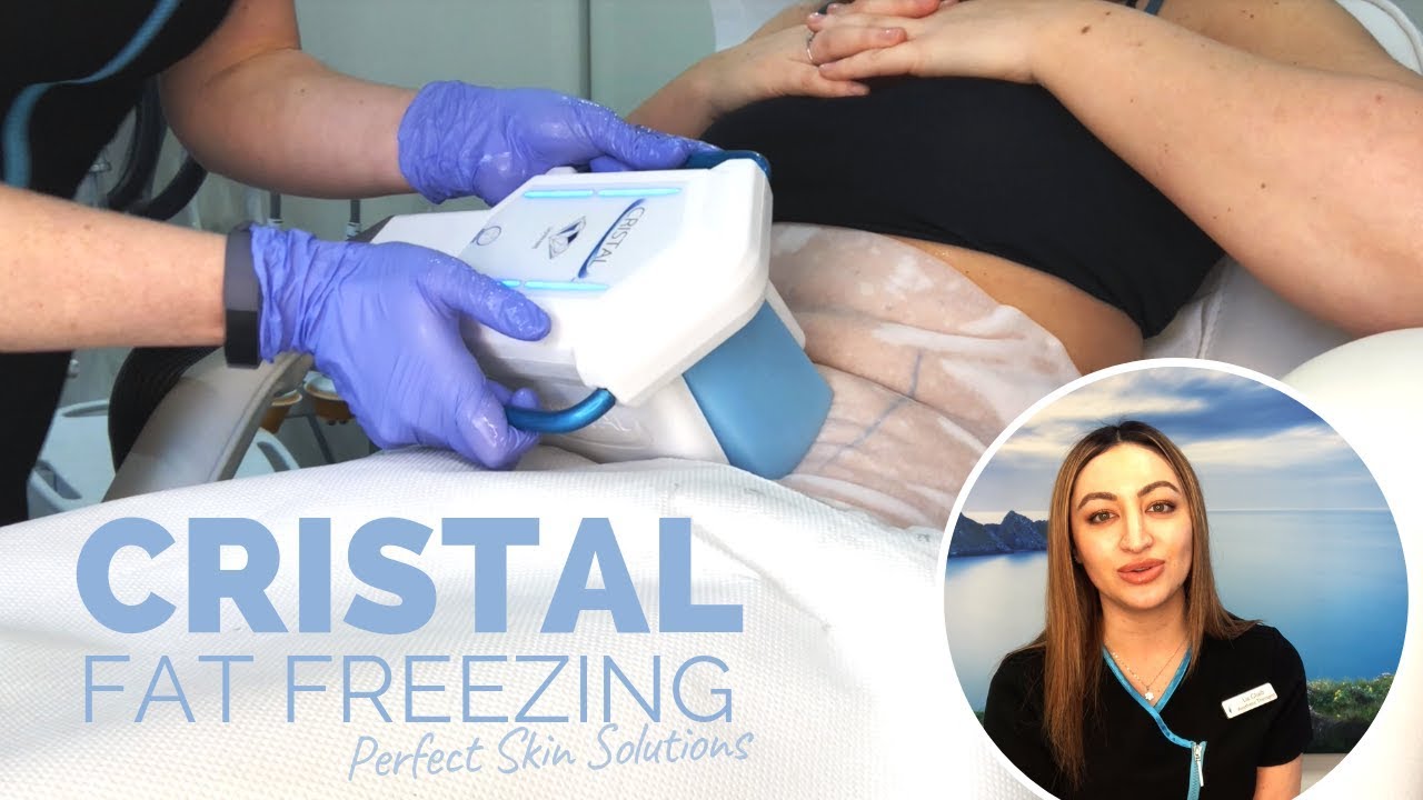 Cristal Fat Freezing at Perfect Skin Solutions