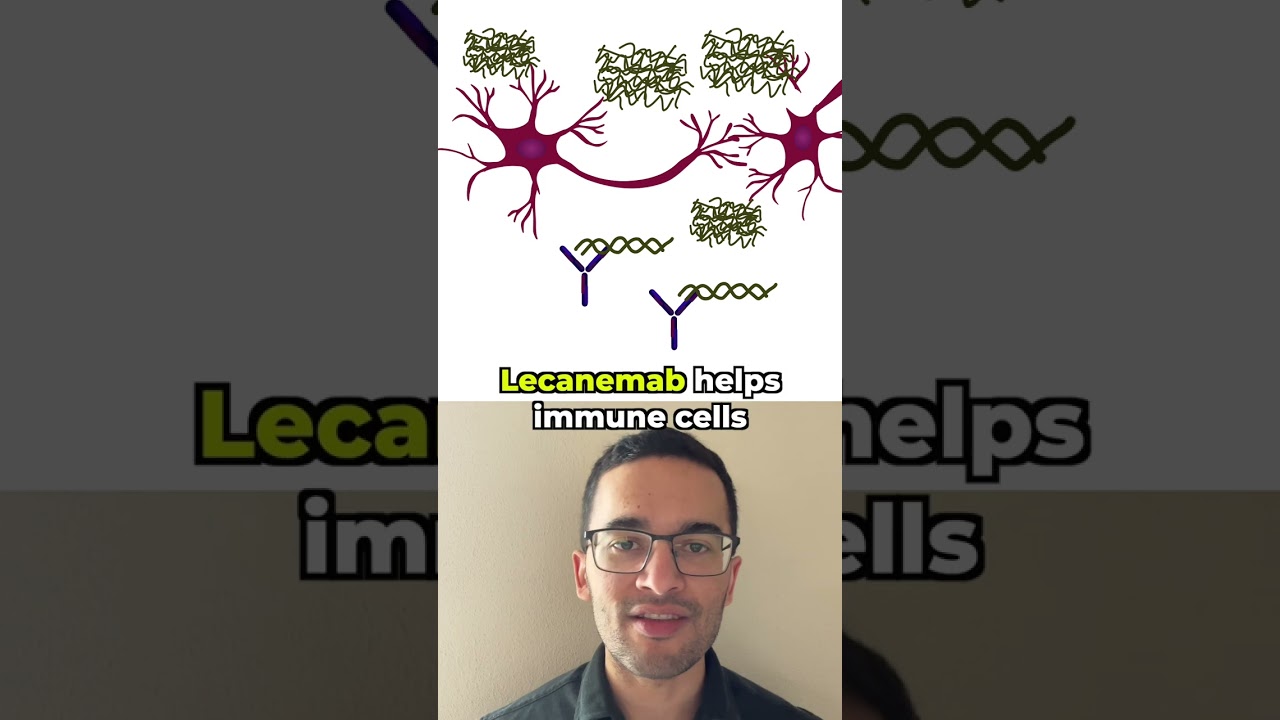 How does the new Alzheimer's disease drug work? Lecanemab-Leqembi