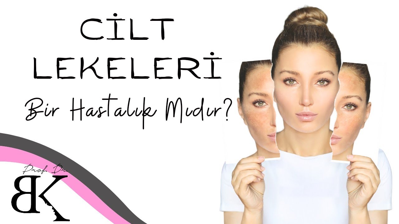 Cilt Lekeleri Tamamen Geçer mi? Leke Hastalık Mıdır? Prof.Dr. Başak Kandi Merak edilenler serisi #63