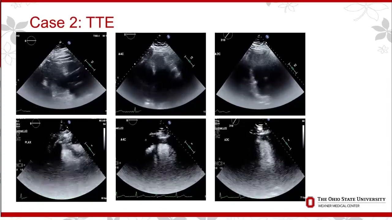 Low-Field Cardiovascular MRI