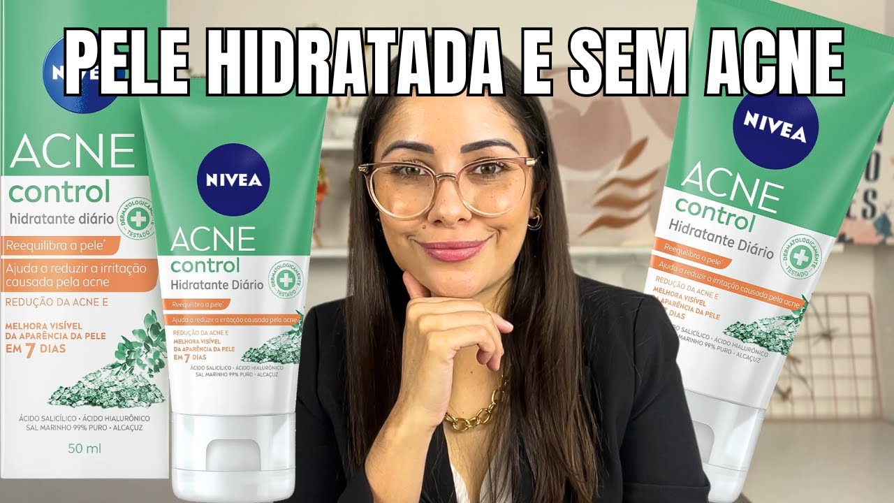 NIVEA Acne Control - Hidratante Facial: Pele hidratada e livre de Acne!!