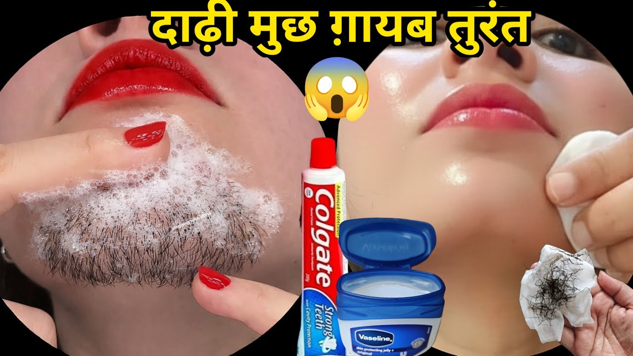 इसे लगाकर साफ कर दो 🤔 पूरी जिंदगी बाल नहीं निकलेगा😱प्रूफ || अनचाहे बालों का समाधान || facial hair