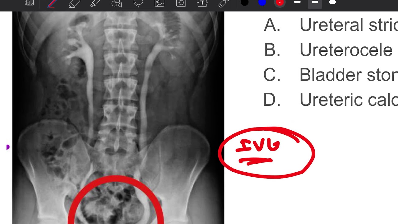 Surgery Image based MCQs | Dr. Pawan Kandhari
