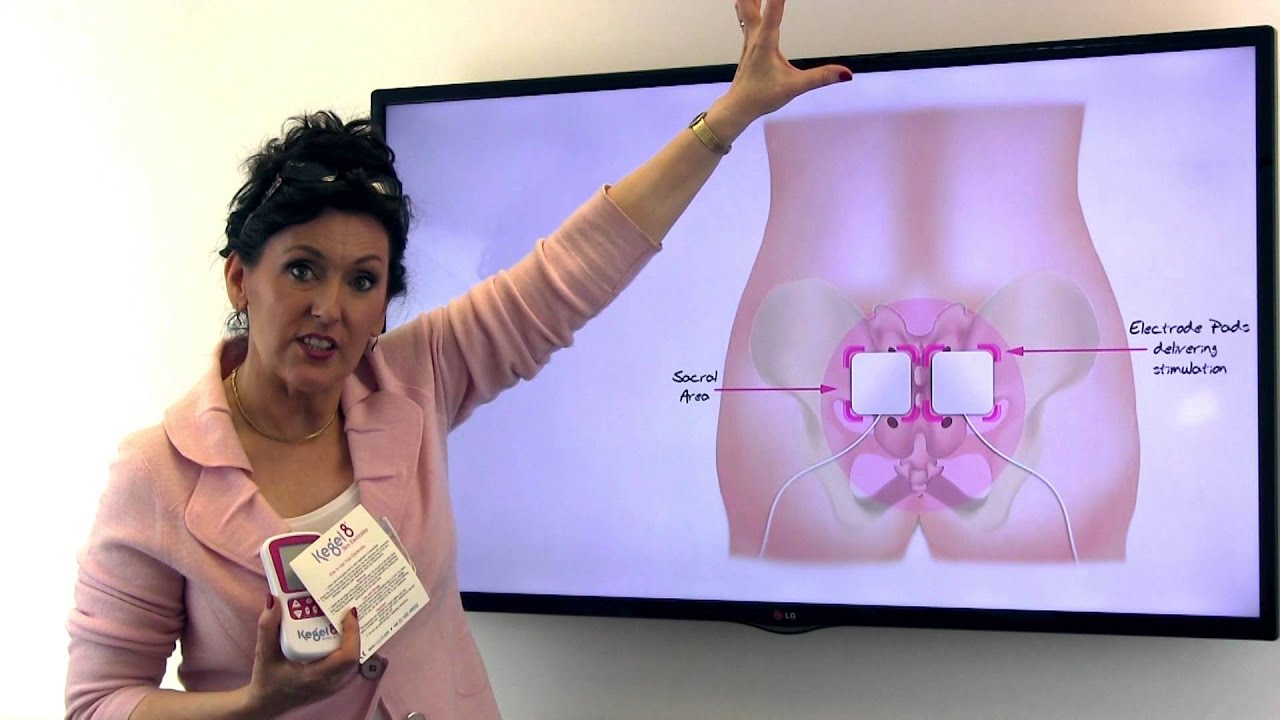 Sacral Nerve Stimulation | Kegel8 Ultra 20 V1 Pelvic Toner | Kegel8
