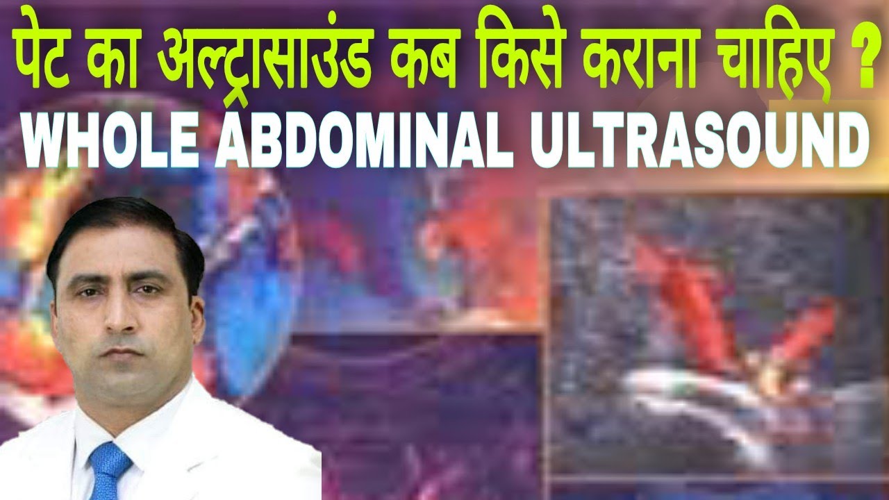 WHOLE ABDOMINAL ULTRASOUND || पेट का अल्ट्रासाउंड कब किसे कराना चाहिए ? || Dr Kumar Education