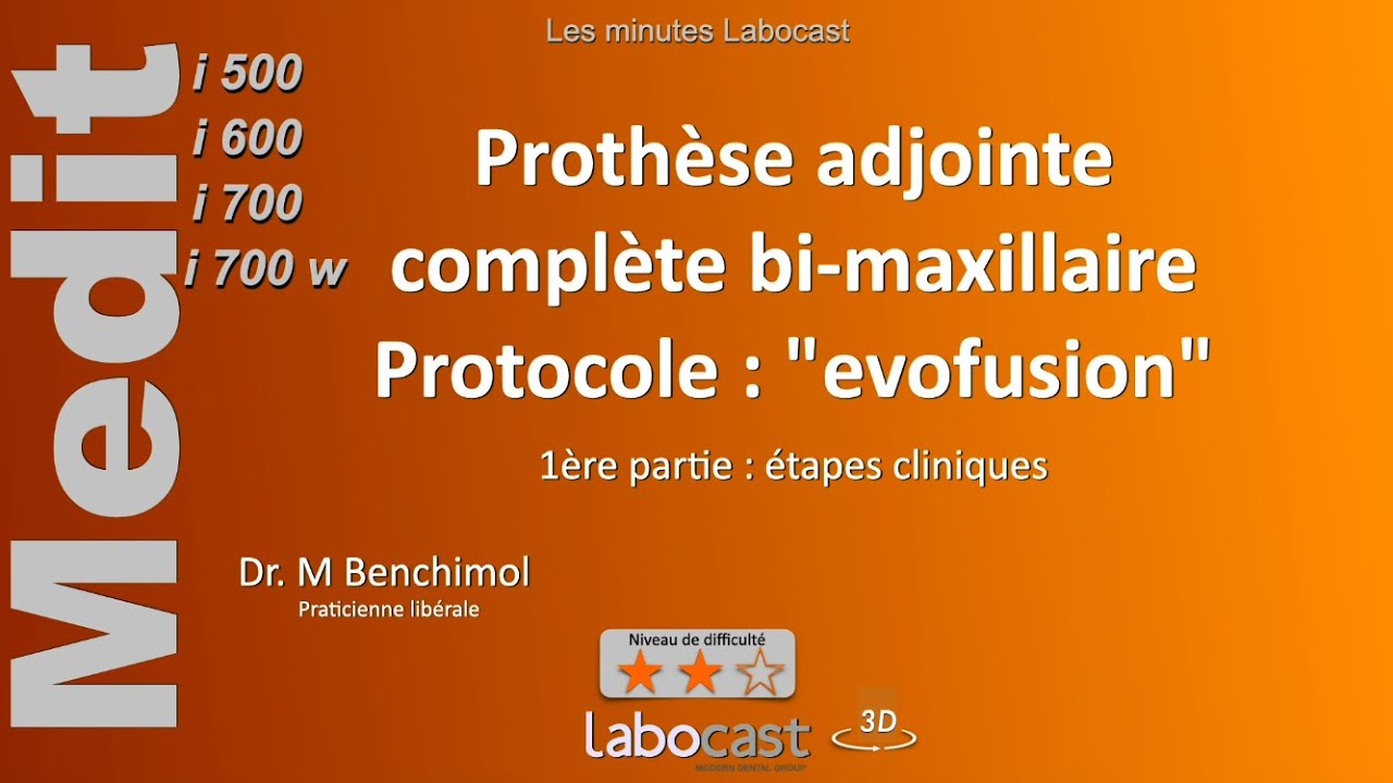 Protocole EVO FUSION : Prothèse adjointe complète bi-maxillaire - 1ère partie : étapes cliniques