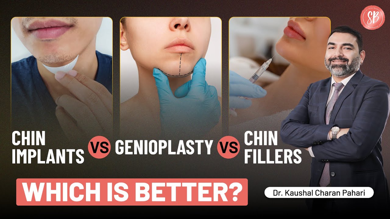 Chin Implants vs. Genioplasty vs. Chin Fillers: Which One Is Right for You? | SB Aesthetics