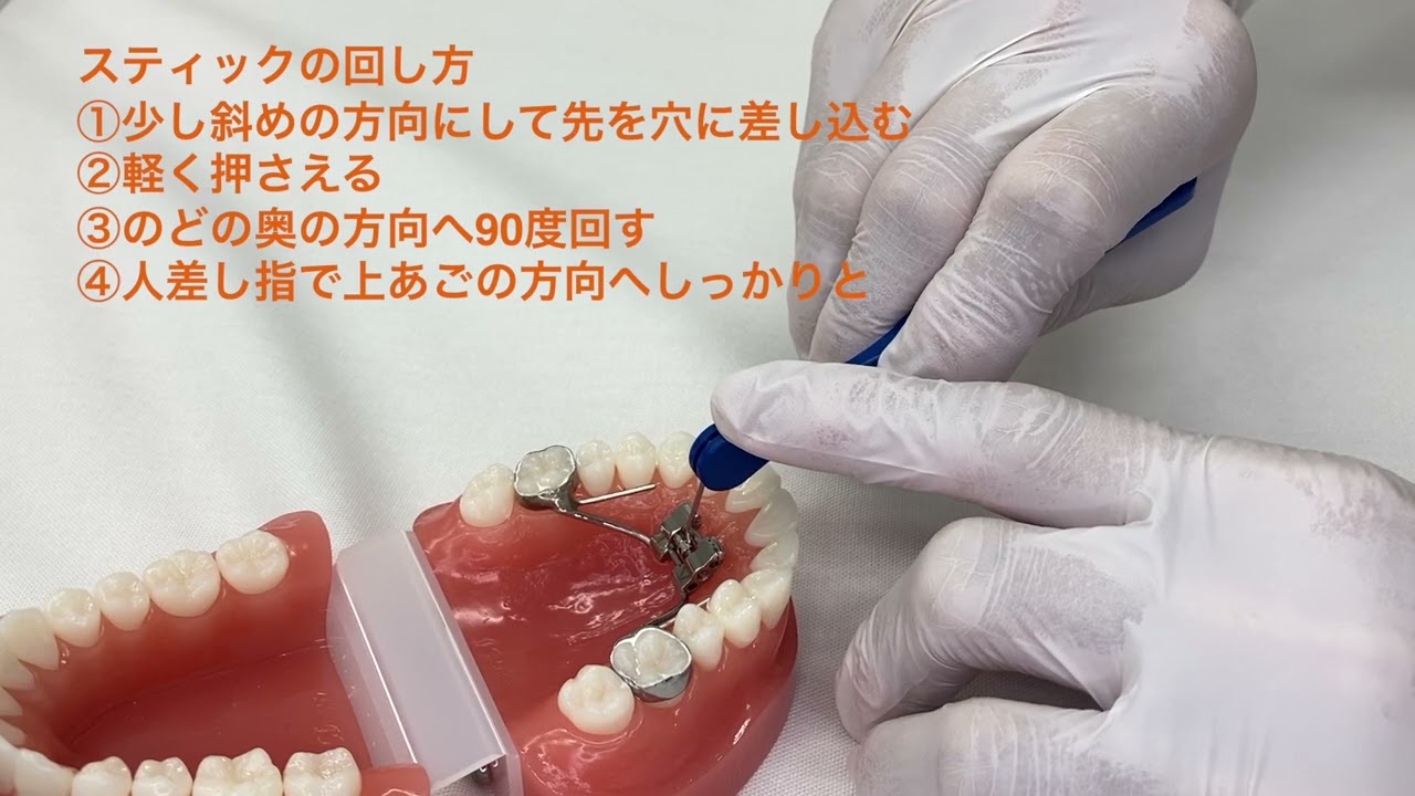 急速拡大装置のネジの回し方