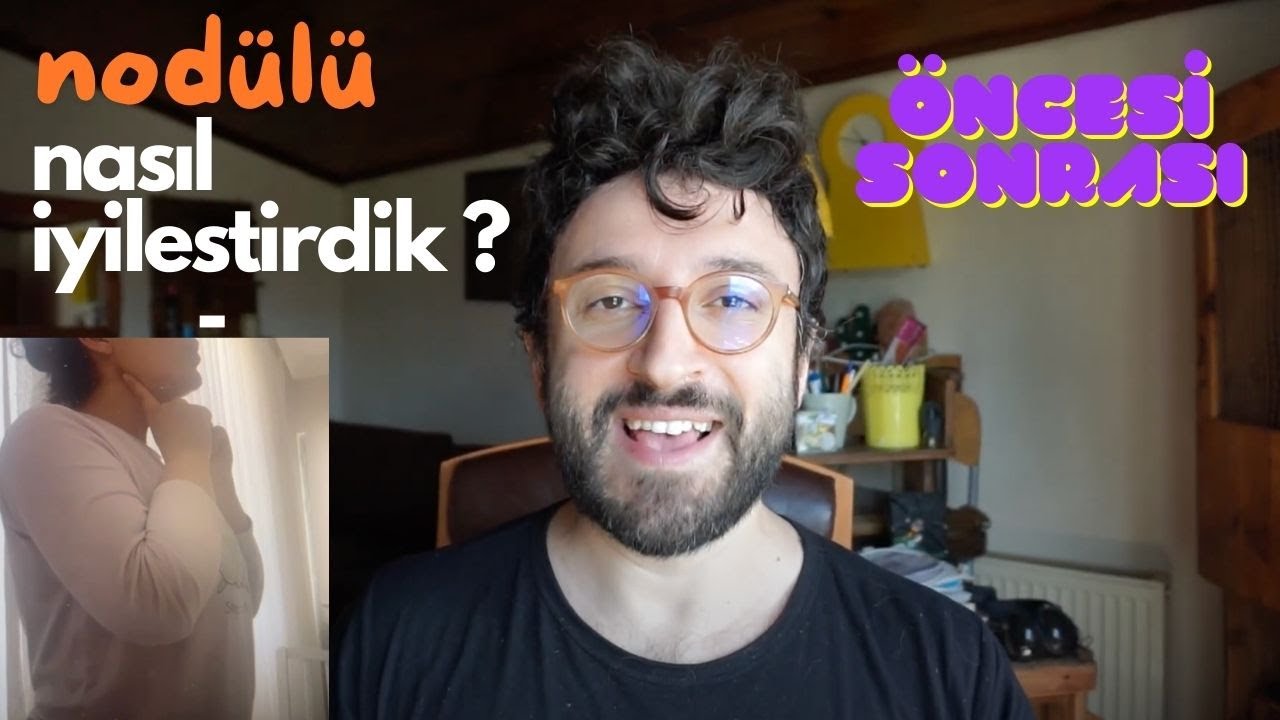 SES TELLERİNDE NODÜLÜ NASIL YOK ETTİK ? ÖNCESİ SONRASI