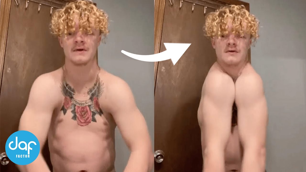 Man BORN WITHOUT A Collarbone
