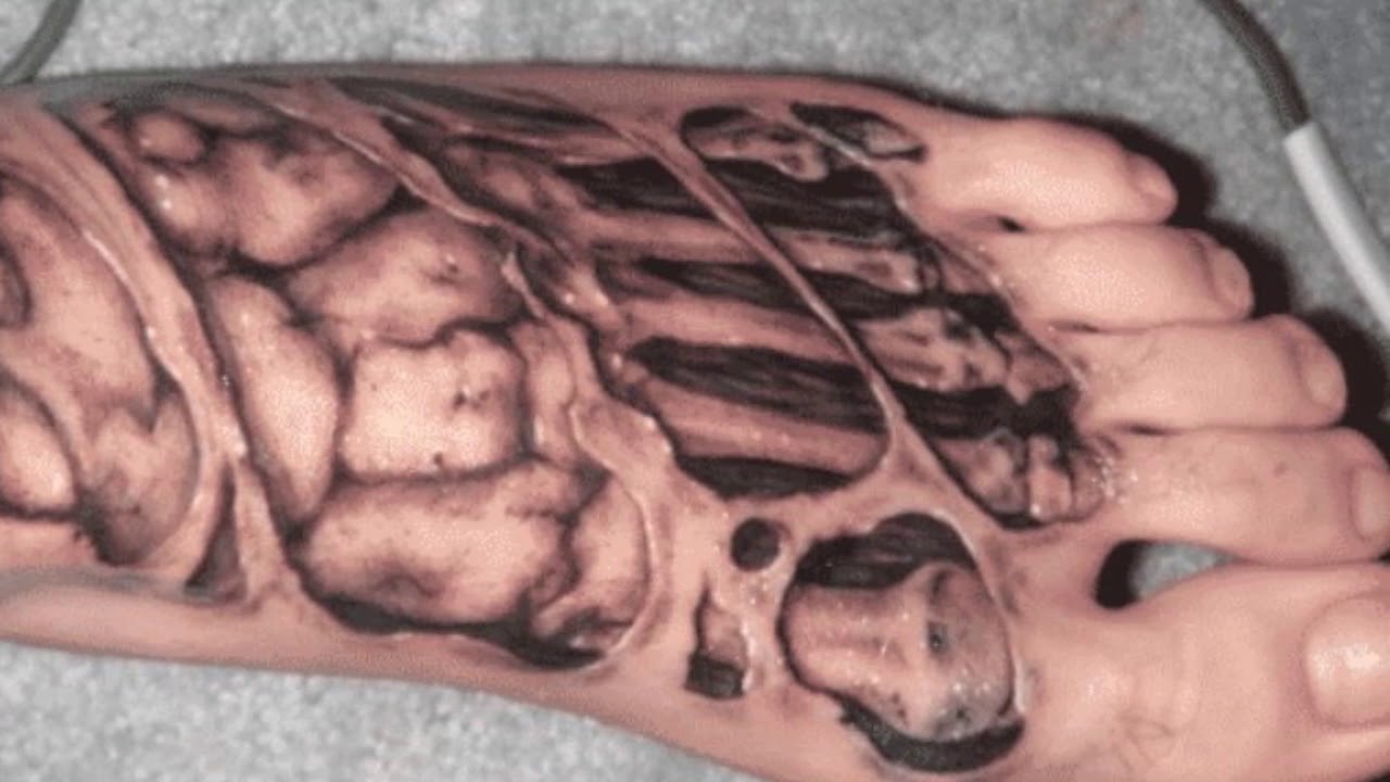 Top 50 Best Ripped Skin Tattoos