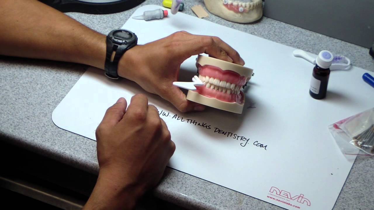 Triple Tray and Adhesive Application.MP4