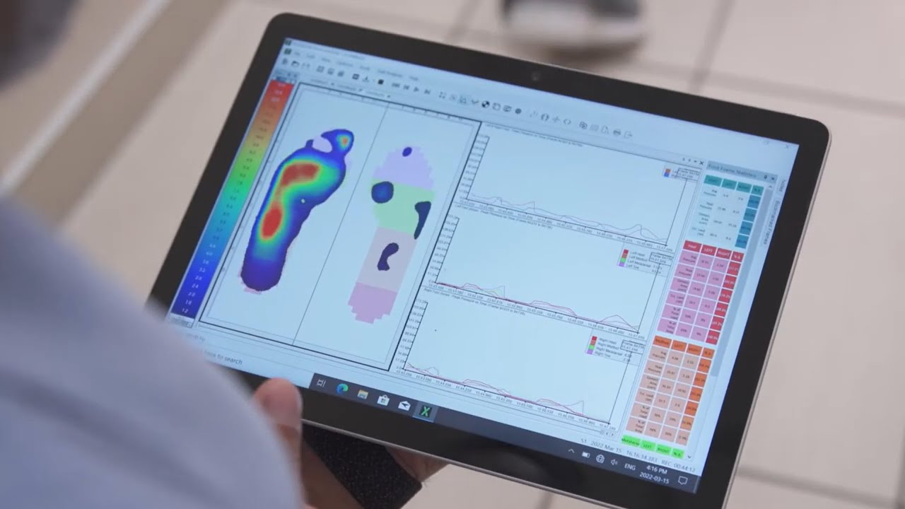 Measure & Evaluate High-Quality Plantar Pressure Data with XSENSOR's Intelligent Insole | Clinical