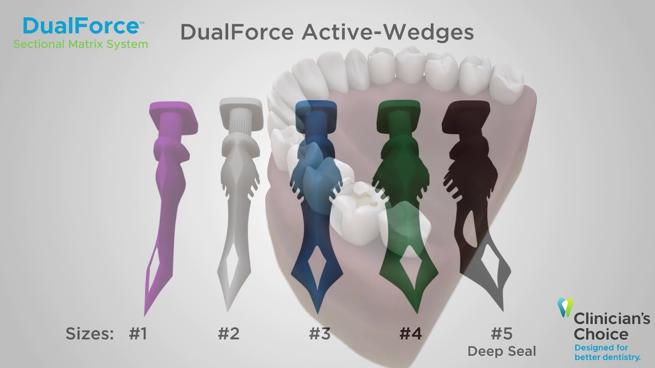 DUAL FORCE Sectional Matrix System Animation
