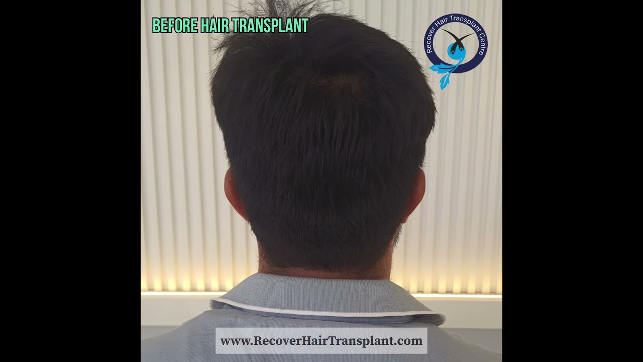 Our satisfied client’s number in the thousands. Guide Entire process, Absolutely amazing results.
