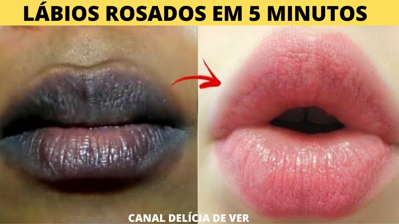 Torne os l&aacute;bios escuros ROSA e MACIOS em APENAS 5 minutos