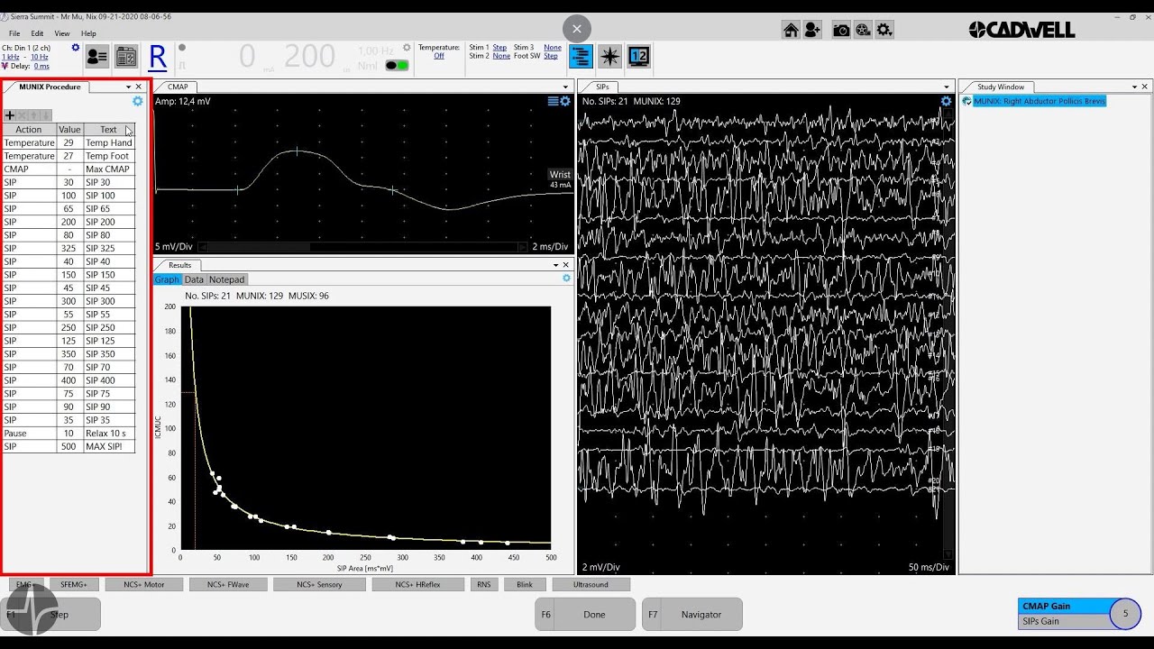 Munix+ Workflow Tutorial - Sierra 4