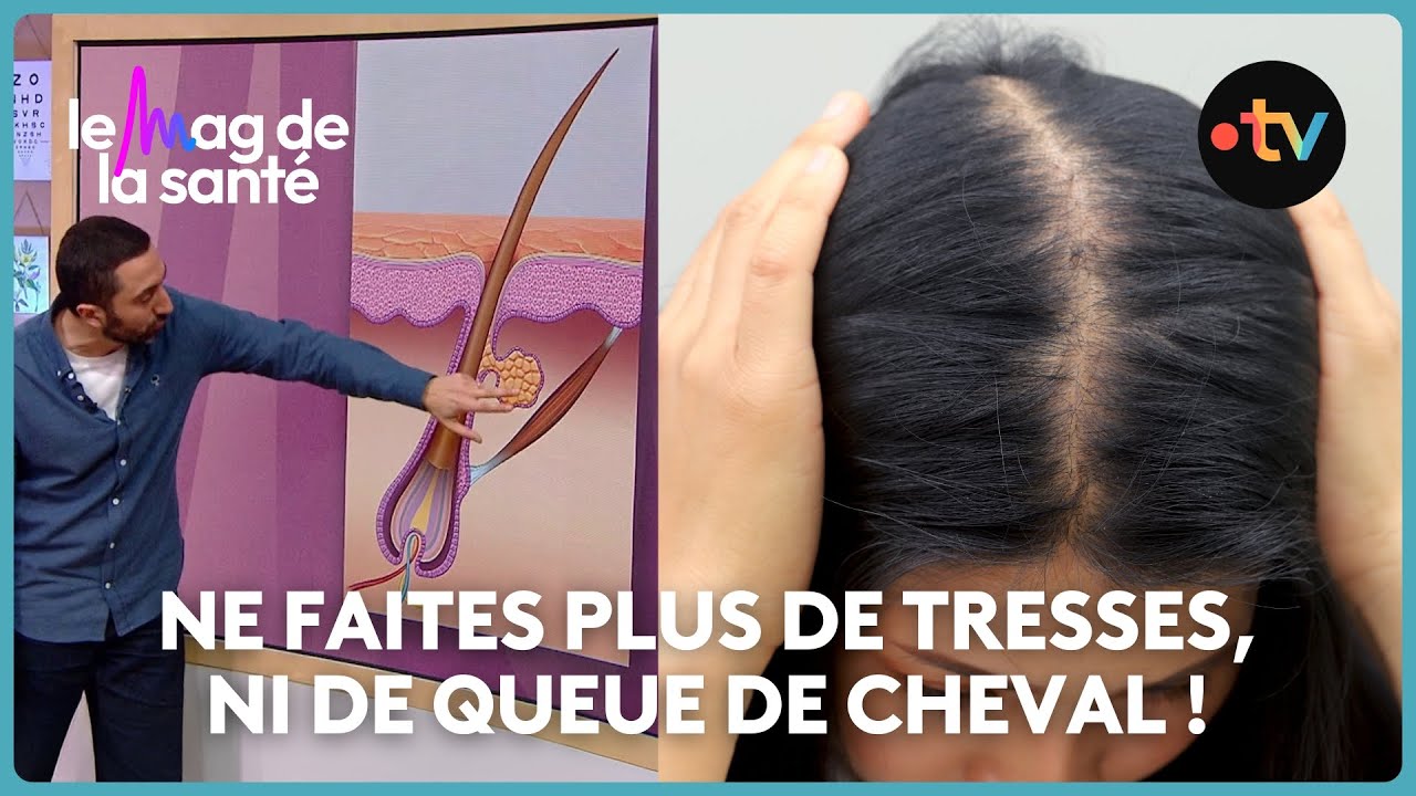 Alopécie : nos conseils pour prévenir la perte de cheveux