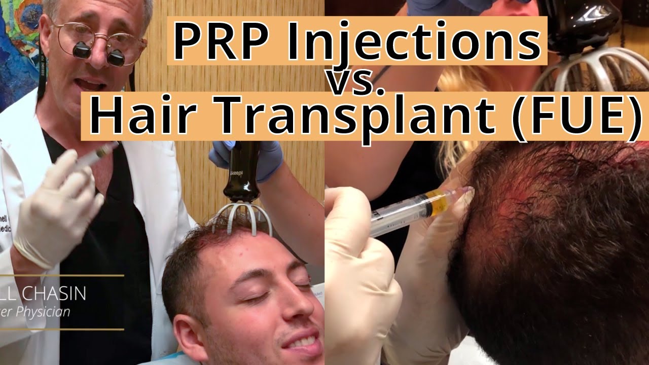 PRP vs. Hair Transplant/FUE [Are you a good candidate?] with Dr. Chasin of Reflections Center in NJ