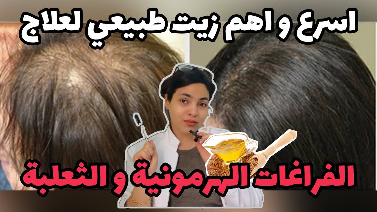 مش هتصدقوا نتيجة الزيت ده من اول اسبوع لعلاج فراغات الشعر✨كنز من متخصص اعشاب وعلاج الشعرTrichologist