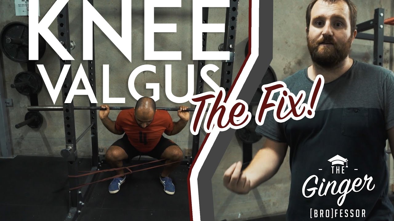 THE GINGER BROFESSOR: KNEE VALGUS - EVERYTHING YOU NEED TO KNOW!
