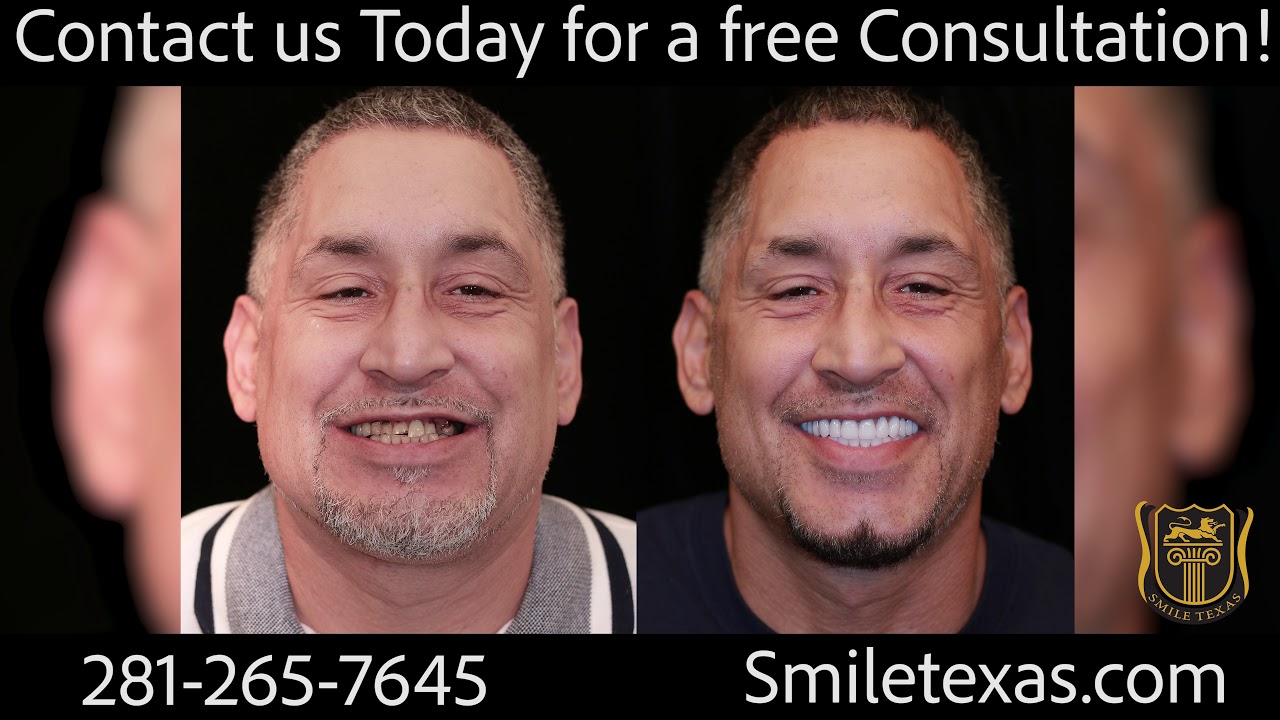 Amazing Teeth By Tonight!