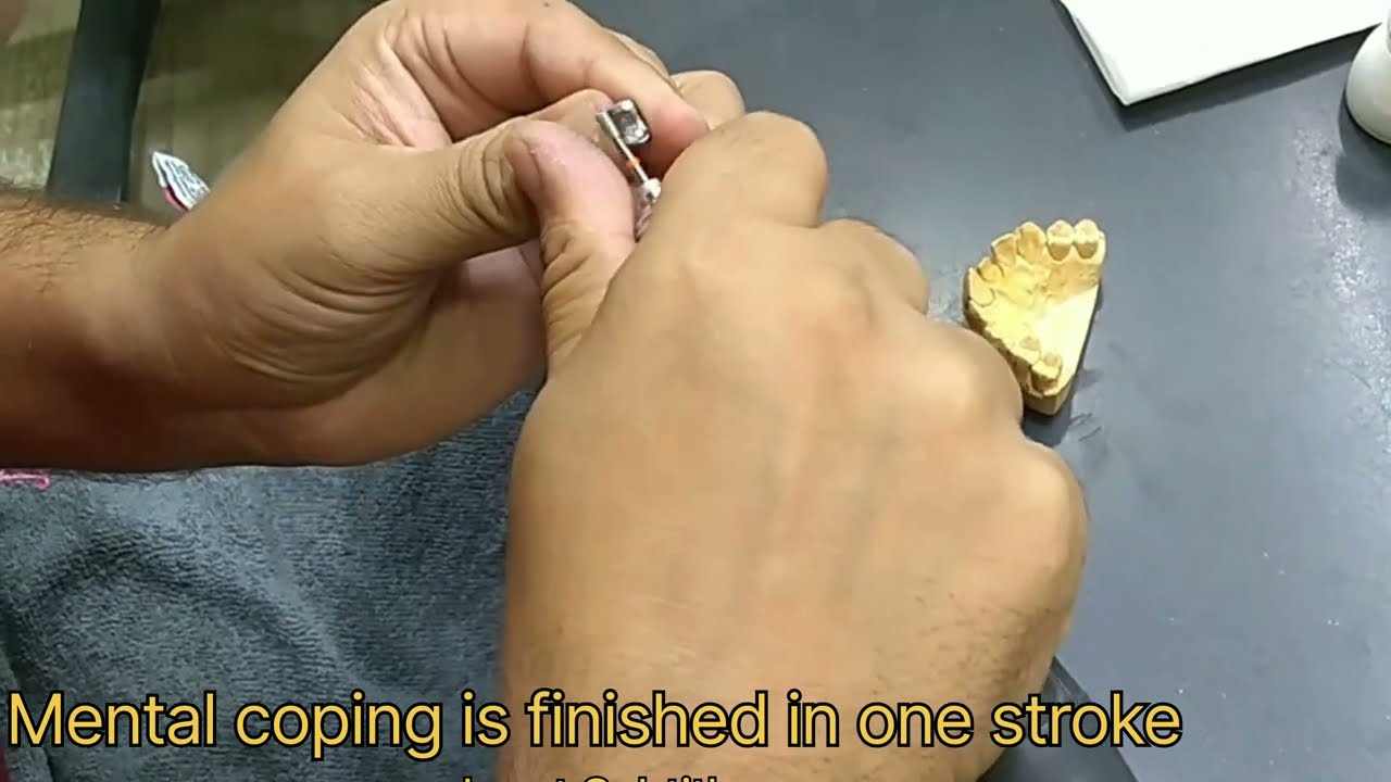 TITANIUM CERAMIC