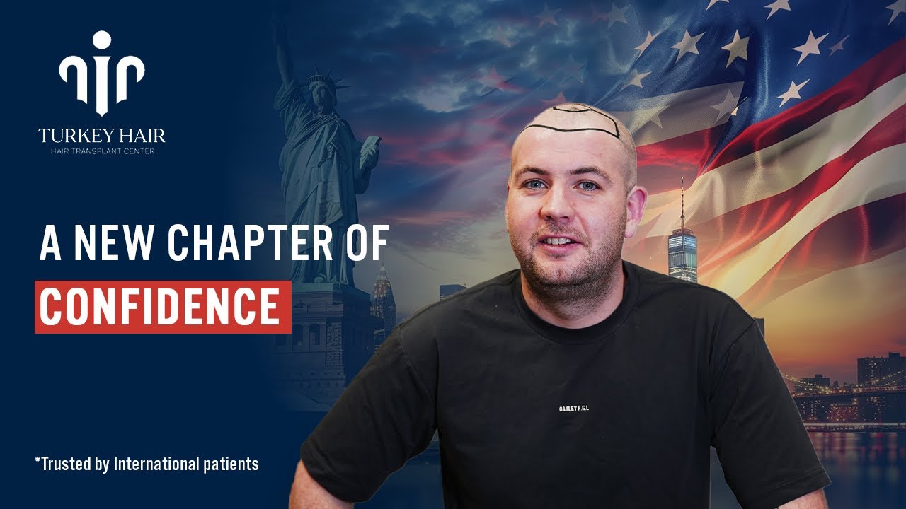 A Trusted Destination for USA Patients: Turkey Hair Transplant Center