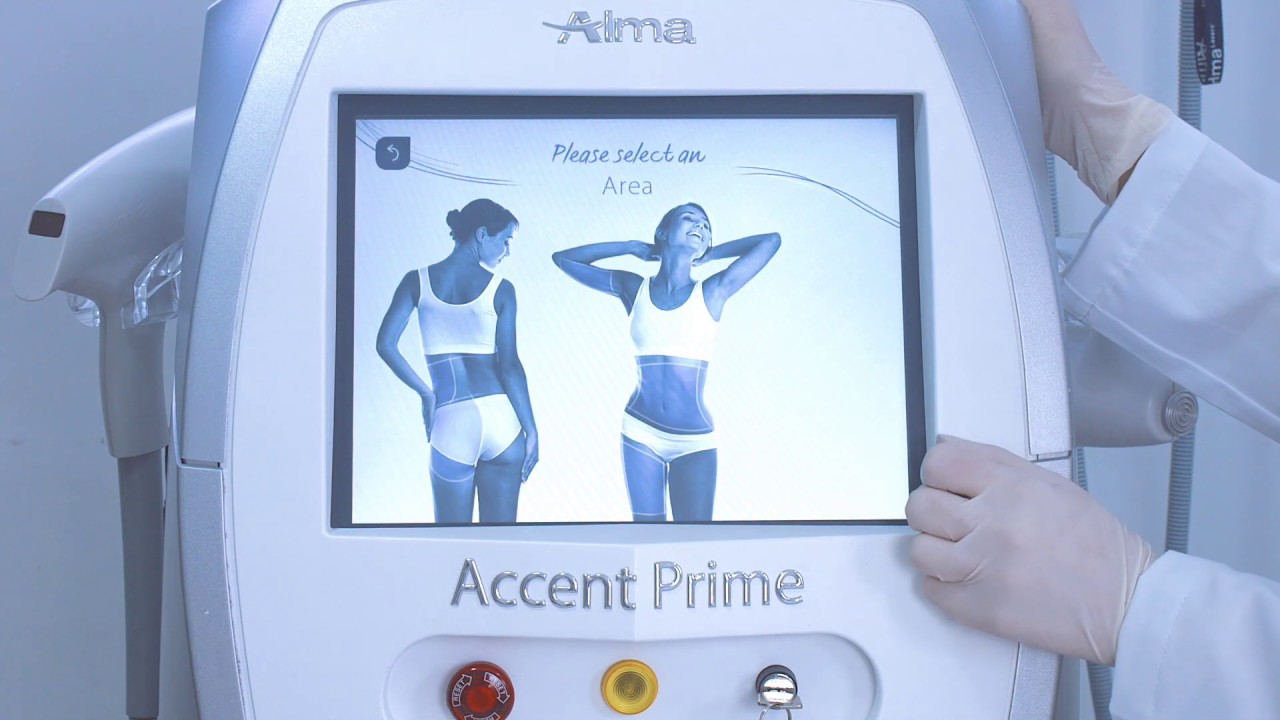 Accent Prime de Alma Lasers (Piezas de mano)