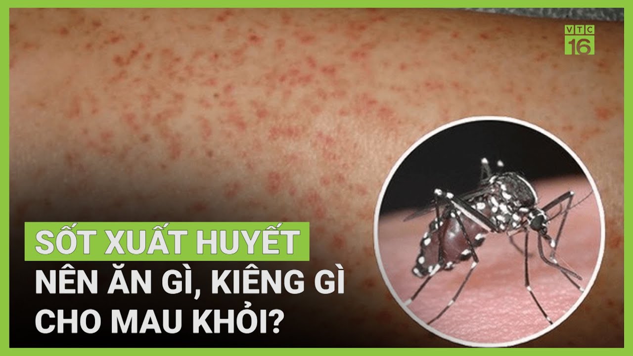 Bị sốt xuất huyết nên ăn gì, kiêng gì nhanh khỏi? | VTC16