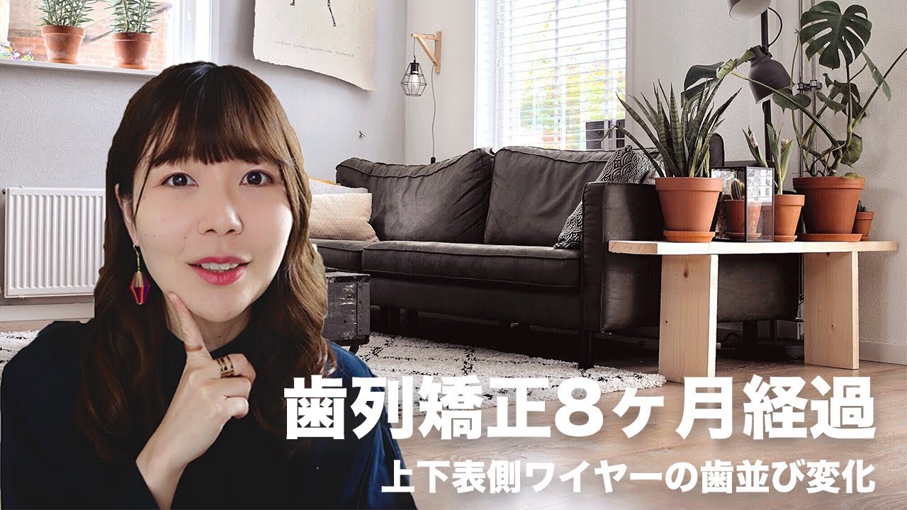 【歯列矯正】上下表側ワイヤーの歯並び変化・食事・ゴムかけ・噛み合わせ / 8ヶ月経過 #4