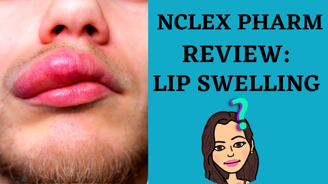 PHARMACOLOGY: CARDIAC MEDICATION CASE STUDY: SWELLING LIPS CAN YOU SOLVE THIS PHARM CASE STUDY?