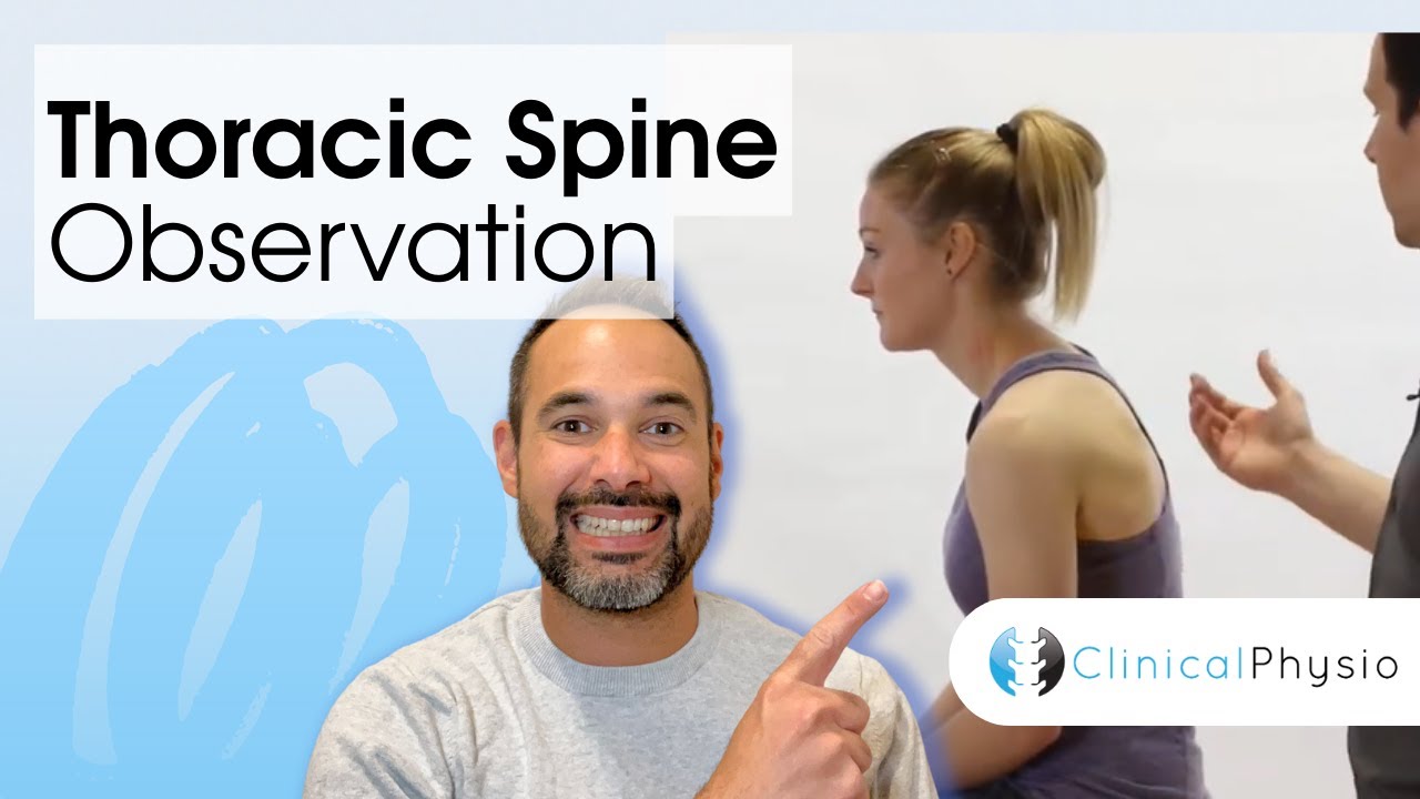 Thoracic Spine Observation | Clinical Physio