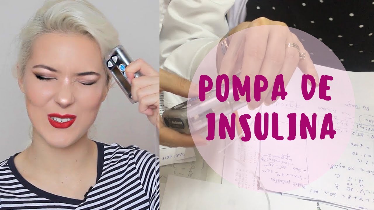 Primele impresii despre POMPA DE INSULINA