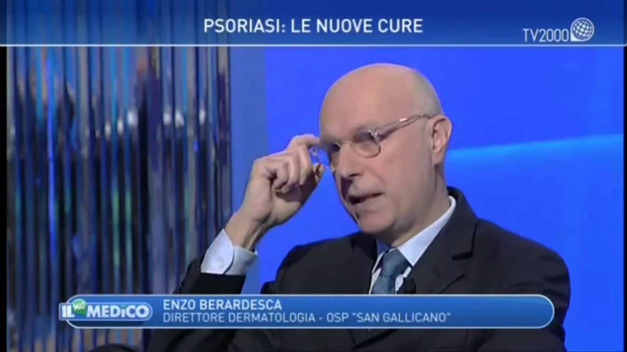 Tutto sulla psoriasi