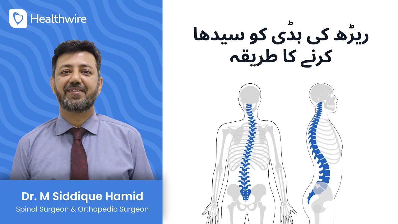 Reedh Ki Haddi Ko Sidha Karne Ka Tarika – Solutions for Spinal Cord Problems
