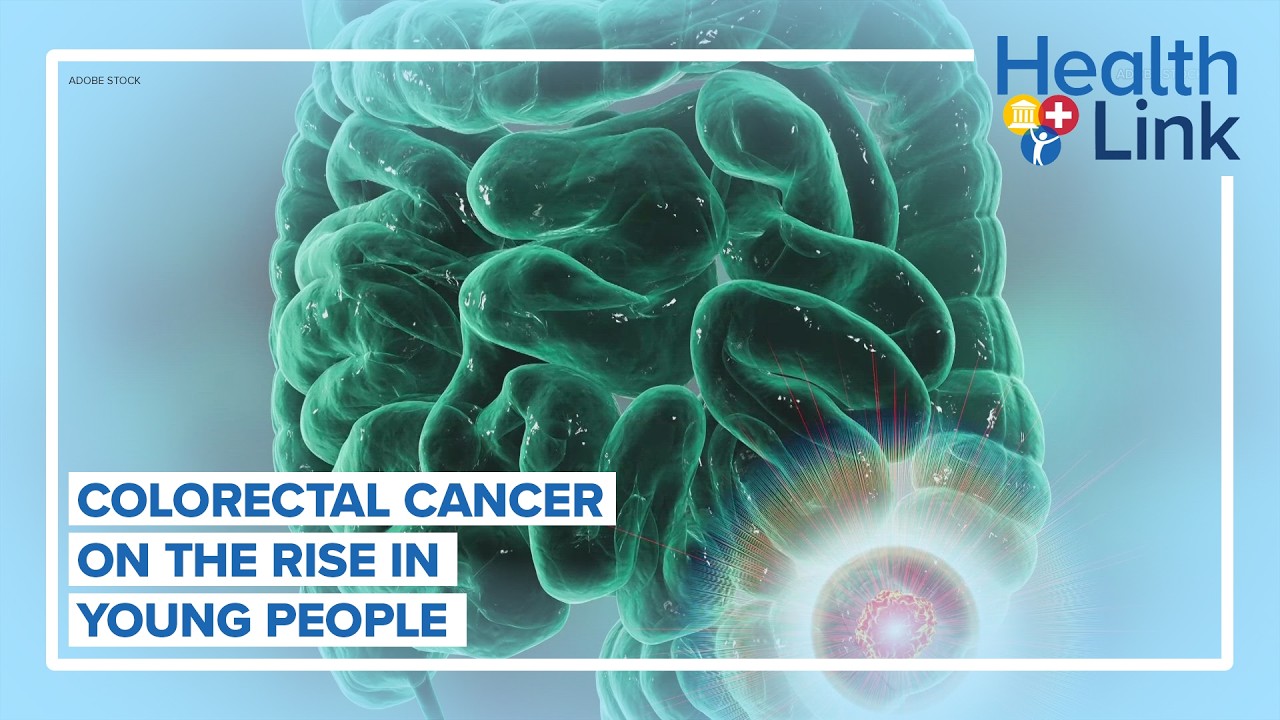 Rise in colorectal cancer in young people: HealthLink