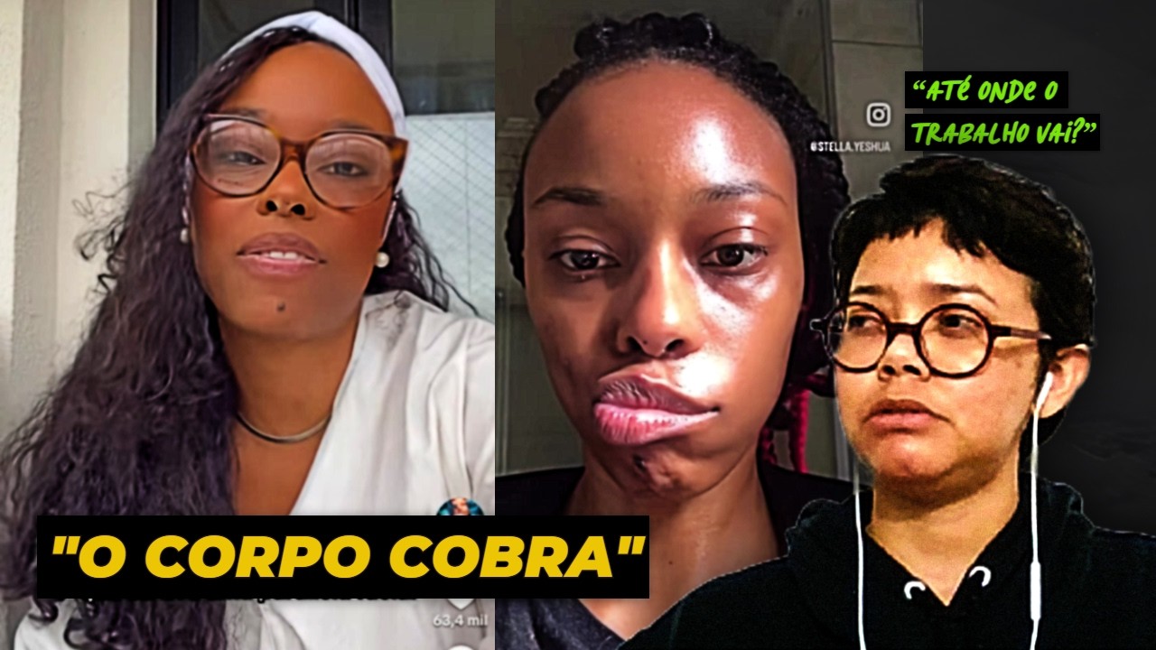 “Tive paralisia facial por trabalhar demais” — até que ponto isso é possível  React