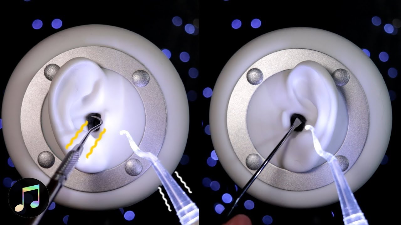 【ASMR】耳垢を引っ掻いて削り取る痛い耳かき - Stainless Ear Pick | No Talking
