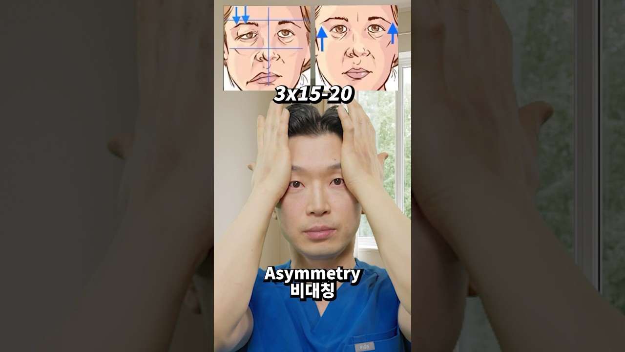 눈 커지고 광대 작아지는 비밀 #EyeSurgery #Cheekbone #FacialContour