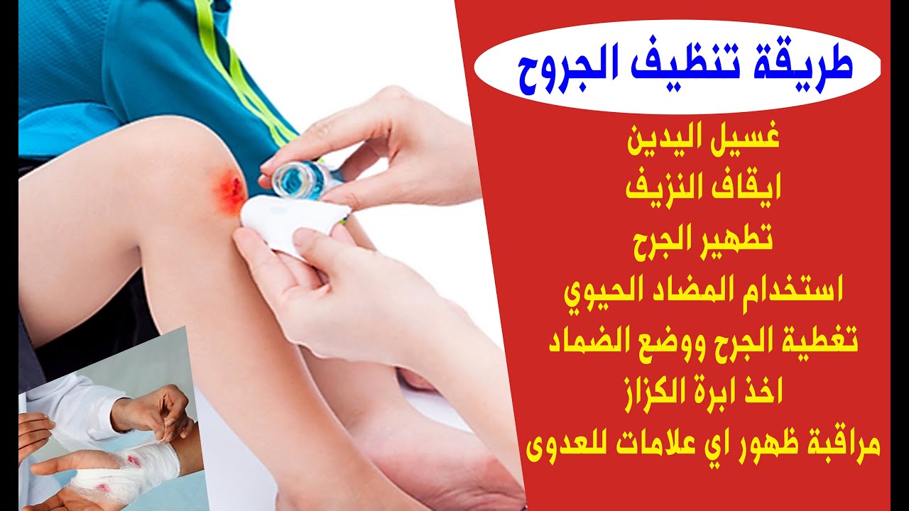 طريقة تنظيف الجروح