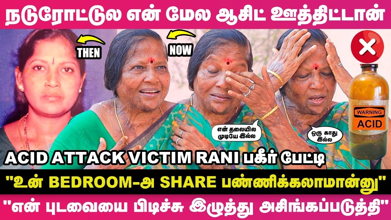 'உன் Bedroom-அ Share பண்ணிக்க வரட்டுமா?'ன்னு தொந்தரவு பண்ணுவாங்க🙄- Acid Attack Victim Rani உருக்கம்😰