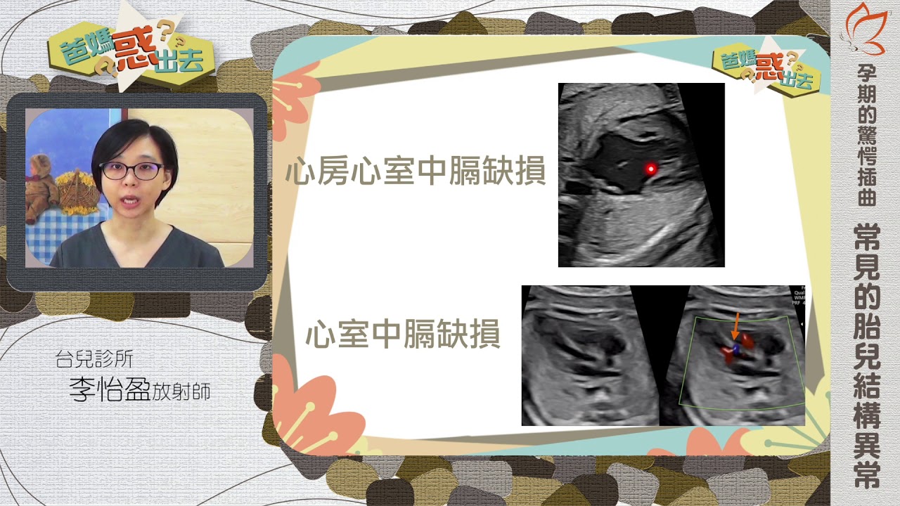 常見的胎兒結構異常（李怡盈放射師）