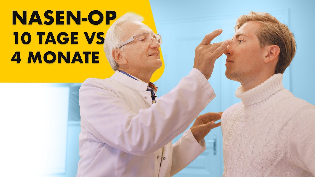 Nasenkorrektur Heilungsverlauf  - 10 Tage VS 4 Monate nach OP | Dr. Jungwirth - plastische Chirurgie