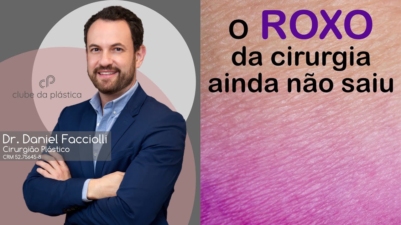 Clube da Plástica: O roxo da minha cirurgia ainda não saiu