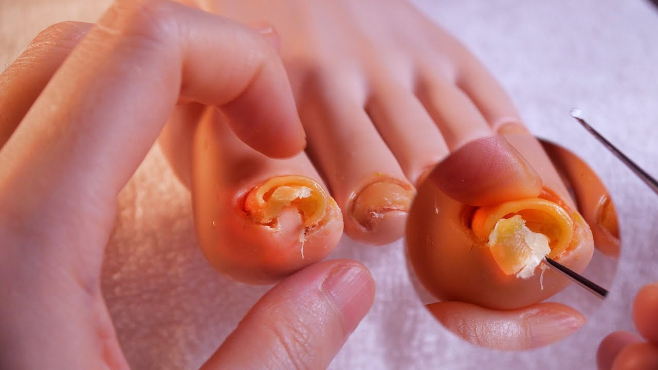 불편한 발톱 시원하게 쫙 펴드립니다 🖐🏻 발 각질 케어까지 #ASMR