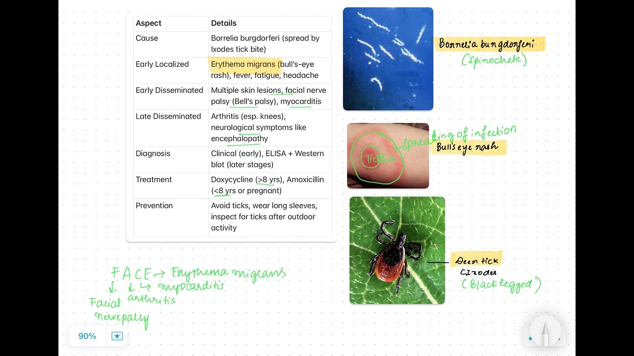 Lyme disease simplified for USMLE/NEET PG