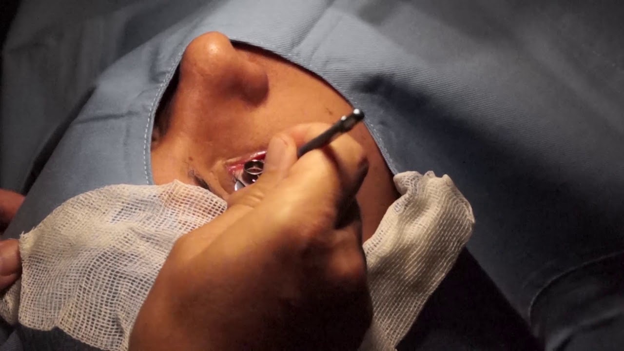 CLÍNICA OFTALMOLÓGICA SANCHO | Tecnología de punta a la vanguardia de la salud visual