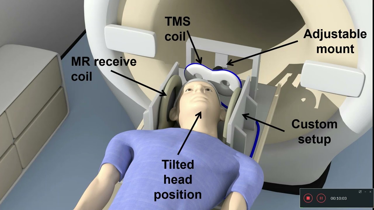 OHBM 2022 | 287 | Symposium | Sebastiaan FW Neggers | Concurrent TMS-fMRI of the dorsolateral pref…