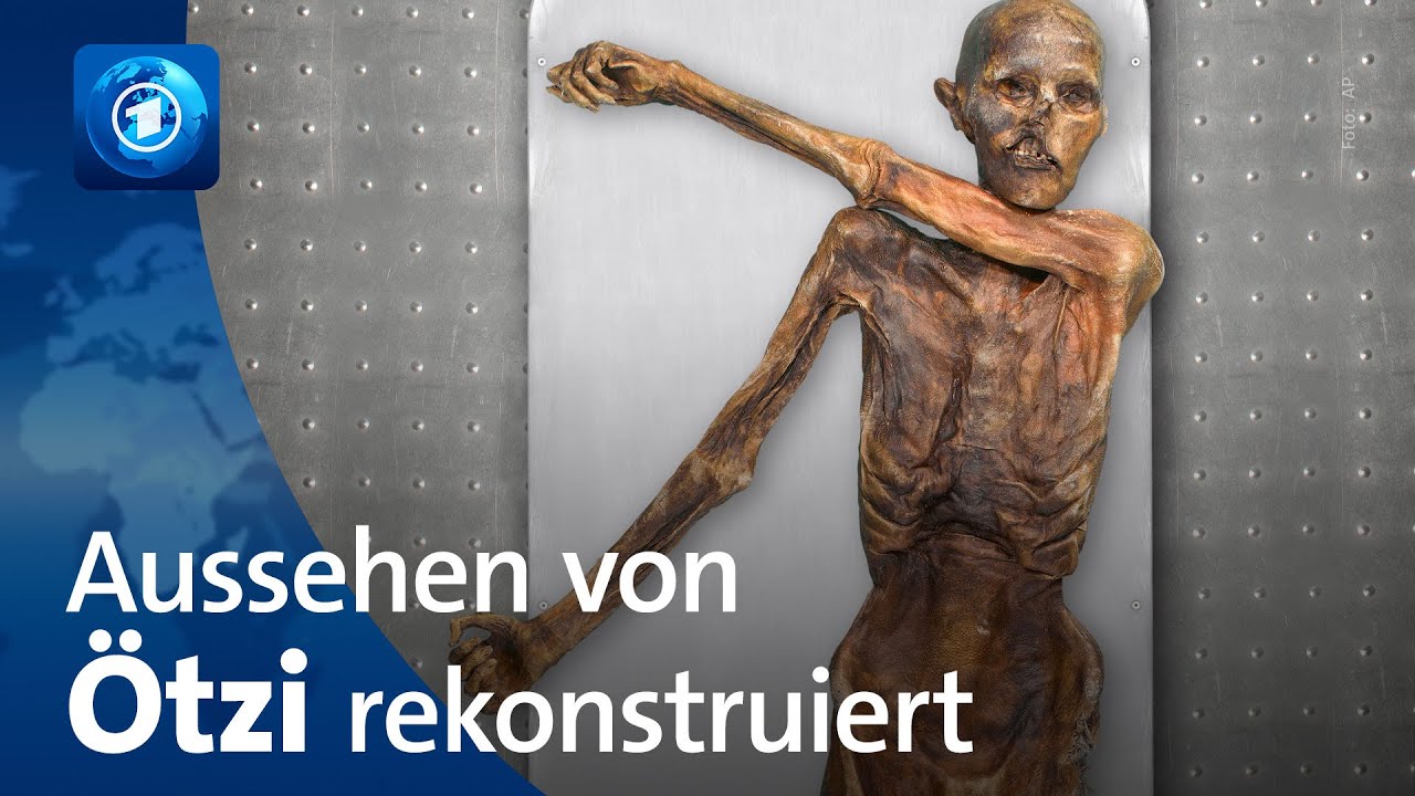Genanalyse: Gletschermann &Ouml;tzi war dunkelh&auml;utig und kahl